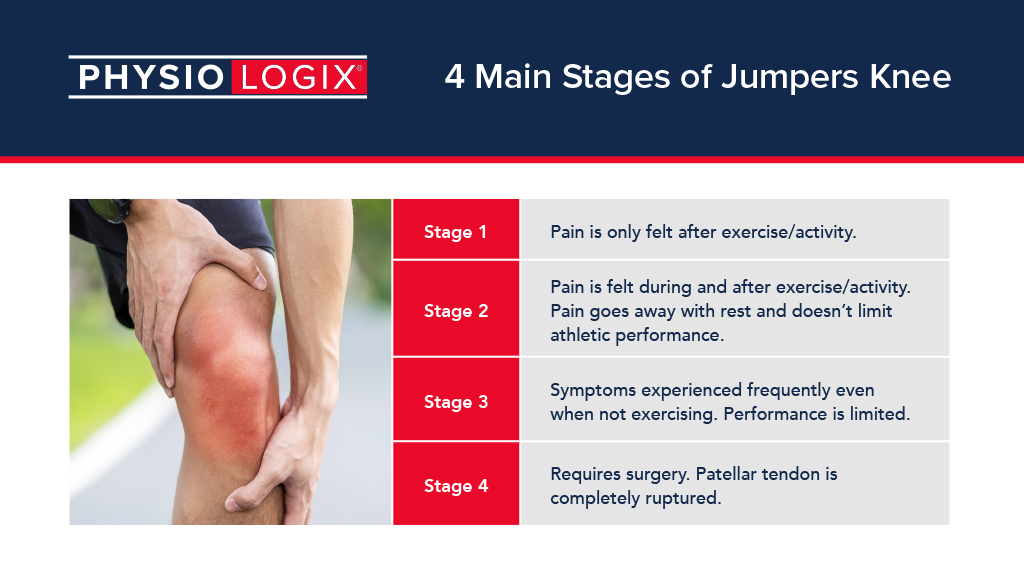 Recover Like a Pro What Is Jumper’s Knee & How to Treat It? Fleming